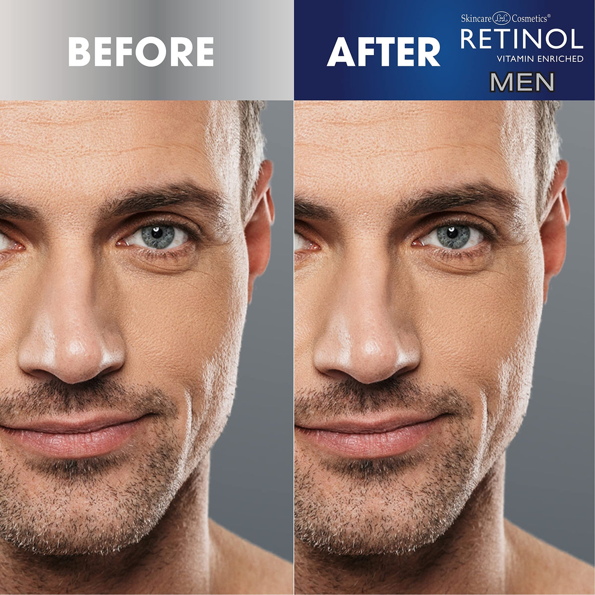 Men's Retinol Eye Cream – Anti-Aging Under Eye Treatment for Fine Lines & Dark Circles