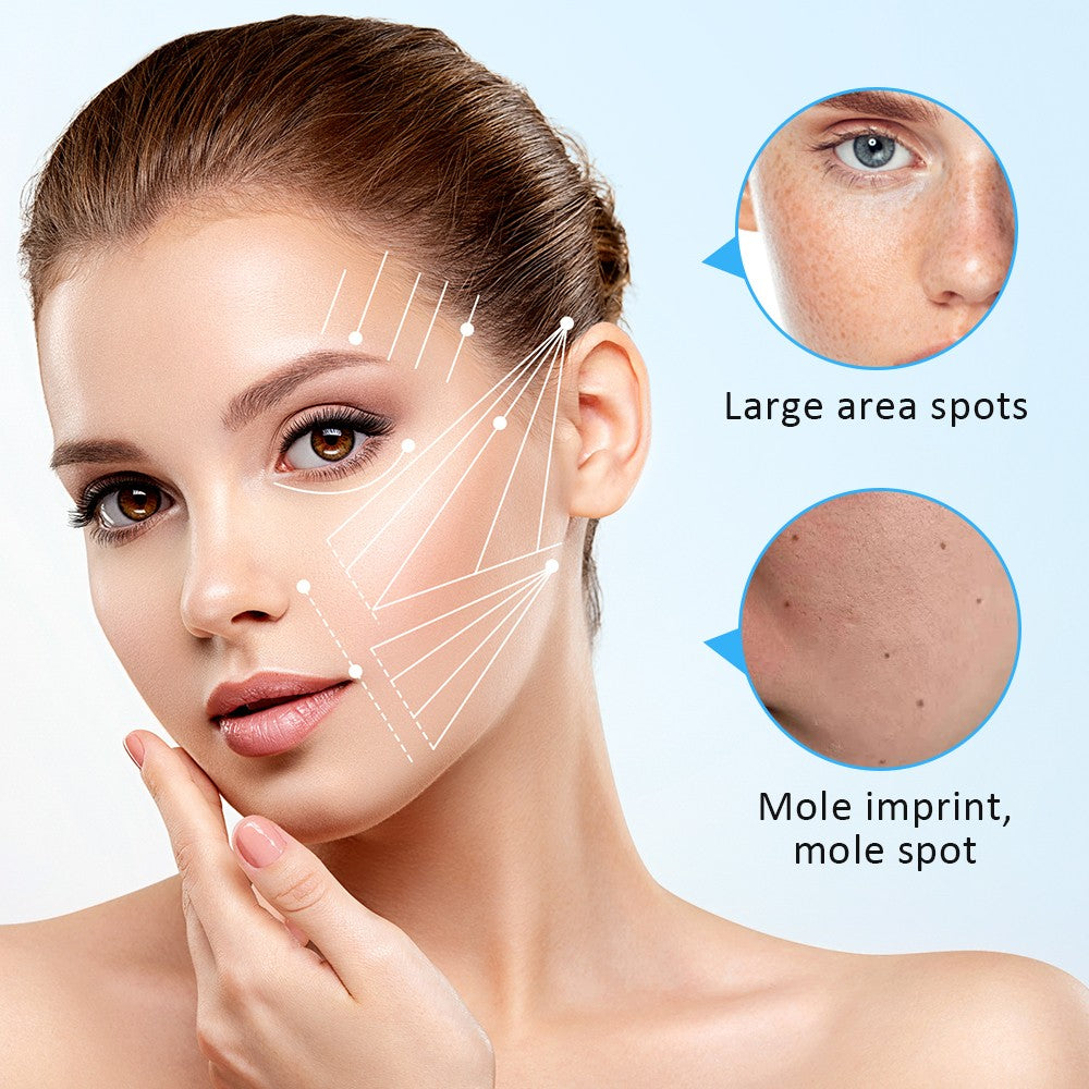 Laser Mole & Skin Spot Removal Pen - 9 Adjustable Levels, Portable, Safe for Home & Salon Use