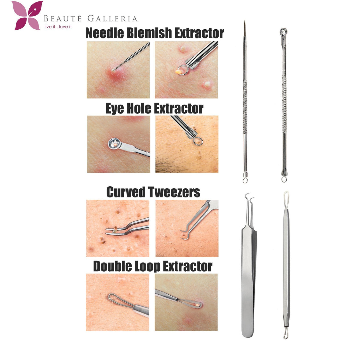4-Pack Stainless Steel Blackhead & Pimple Extractor Tools Set for Acne & Blemish Removal