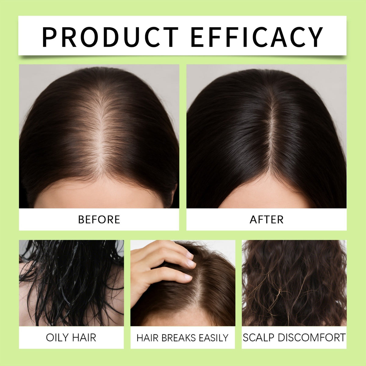 Hair Regrowth Serum - Advanced Treatment for Thicker Hair