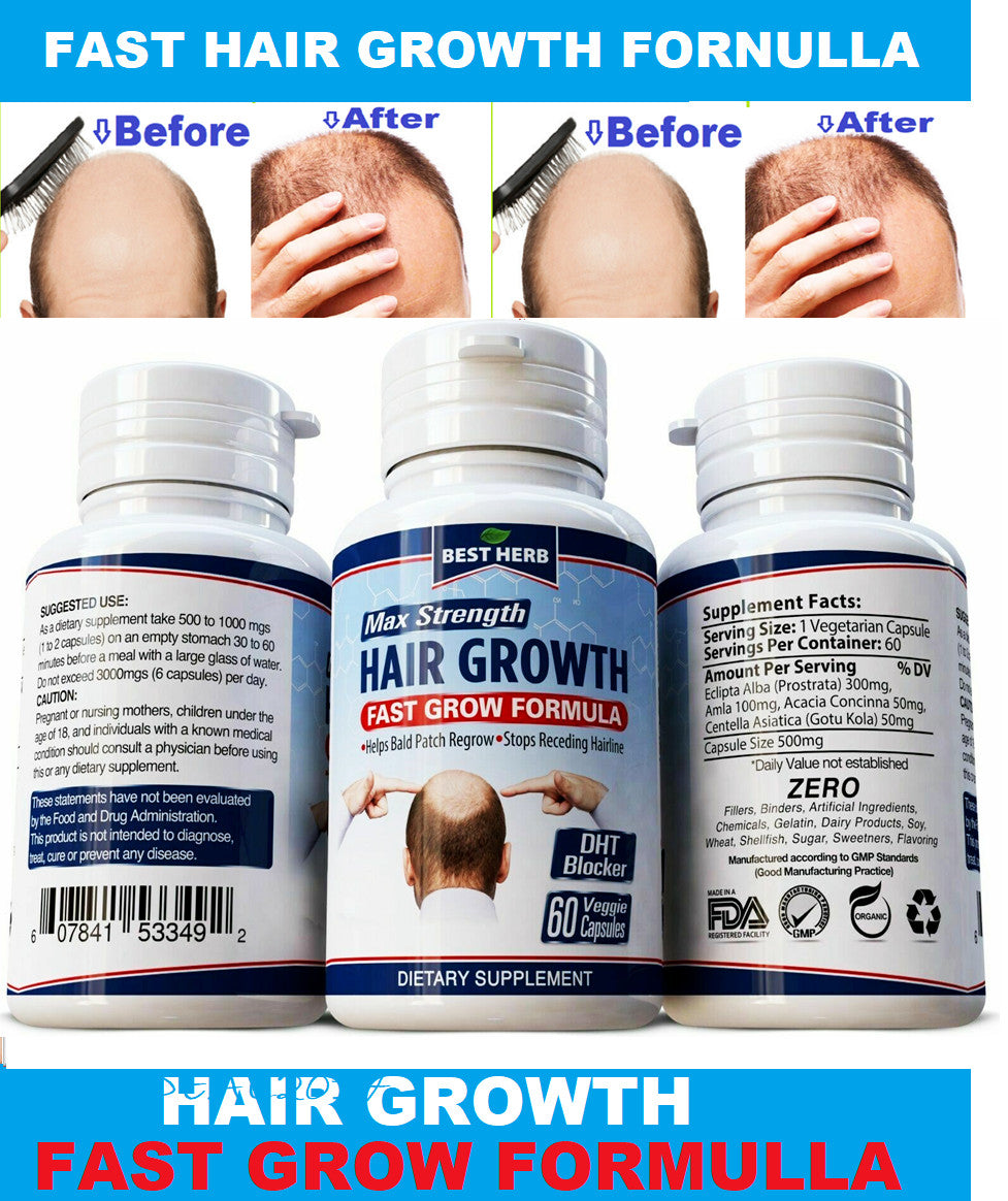 Hair Growth Supplement Pills - 120 Capsules Anti-Hair Loss