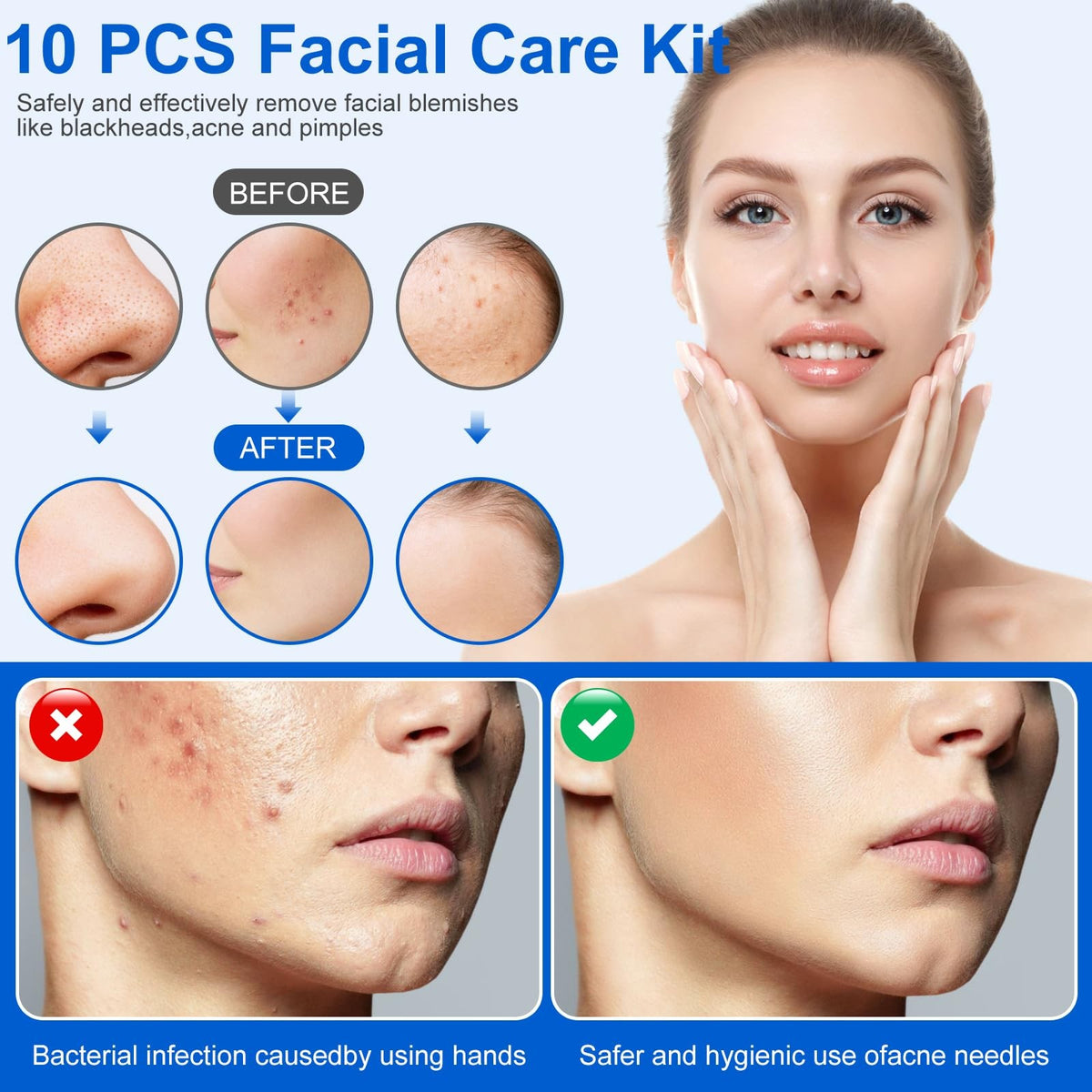 Professional Blackhead Remover Tool Kit - 10 Pcs Skin Care Extractors