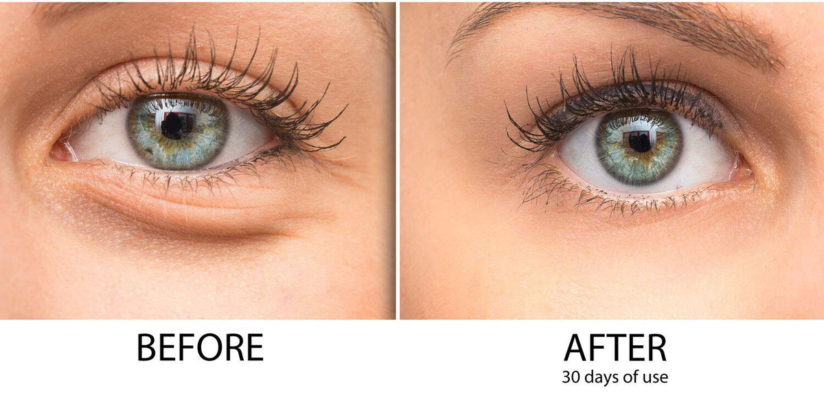 Peptide Eye Serum with Hyaluronic Acid & Vitamin C for Dark Circles & Wrinkles