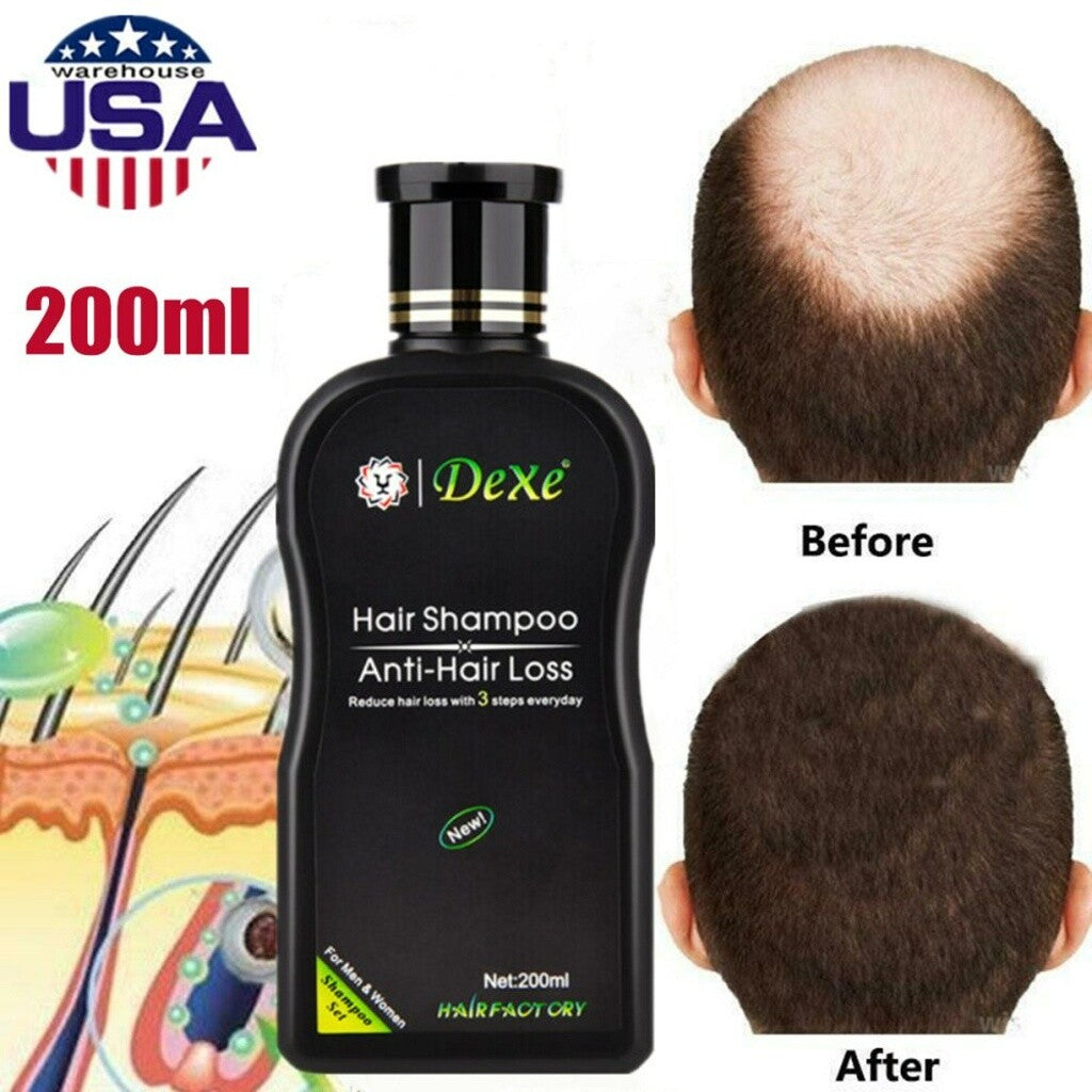 Anti-Hair Loss Shampoo for Men & Women - 200ml