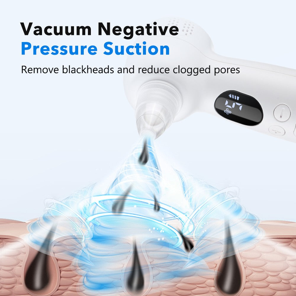 Electric Blackhead Remover Pore Vacuum with 4 Heads & Hot Compress