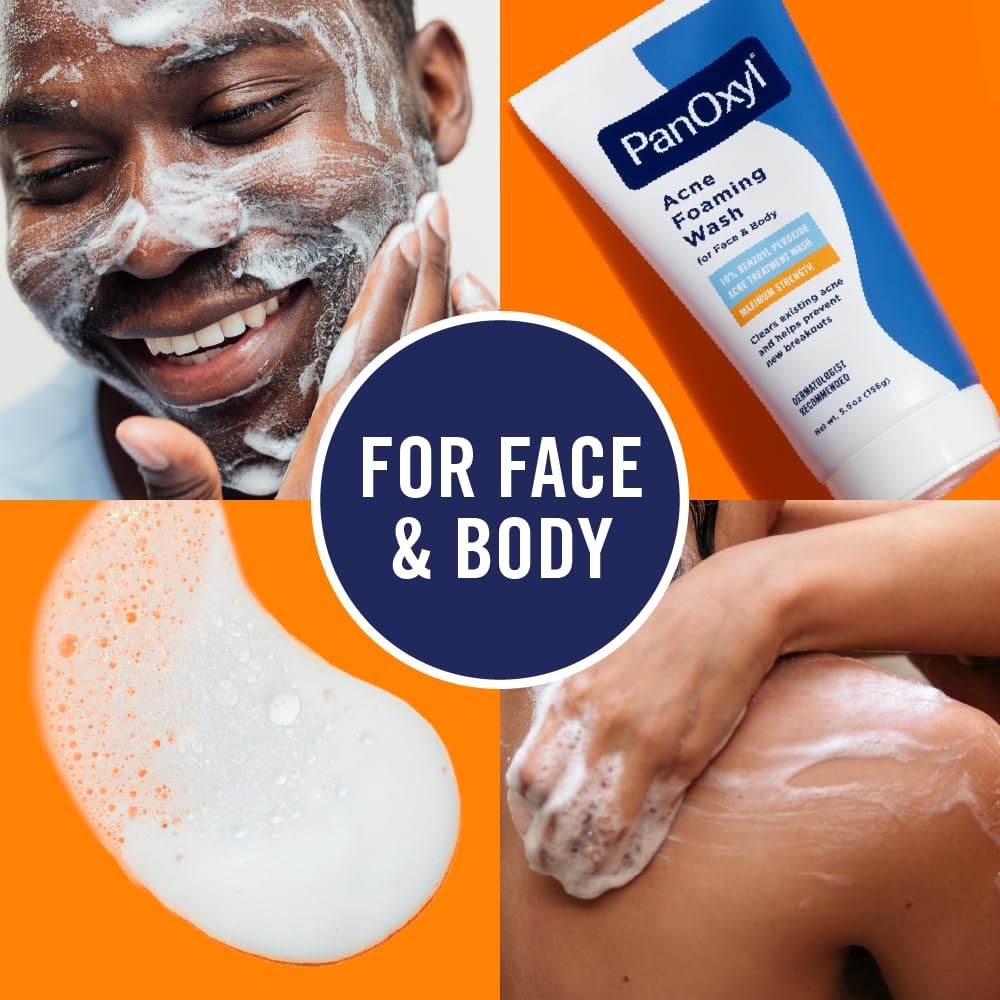 Acne Foaming Wash 10% Benzoyl Peroxide Maximum Strength