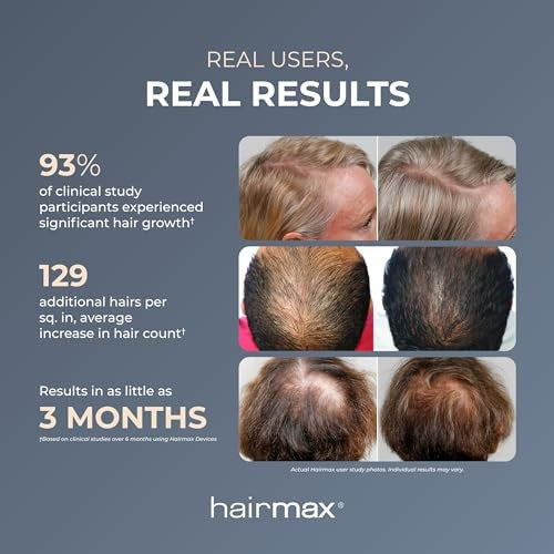 WHITE/BLUE - HAIRMAX ULTIMA 12 HAIR GROWTH LASER COMB
