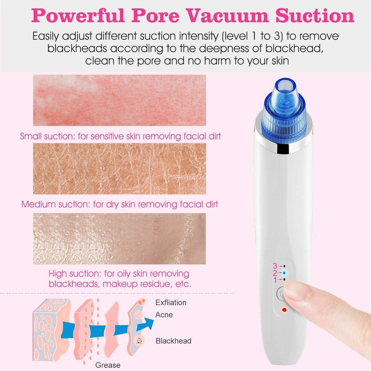 Electric Blackhead Remover Vacuum Pore Extractor with 4 Probes - USB Rechargeable