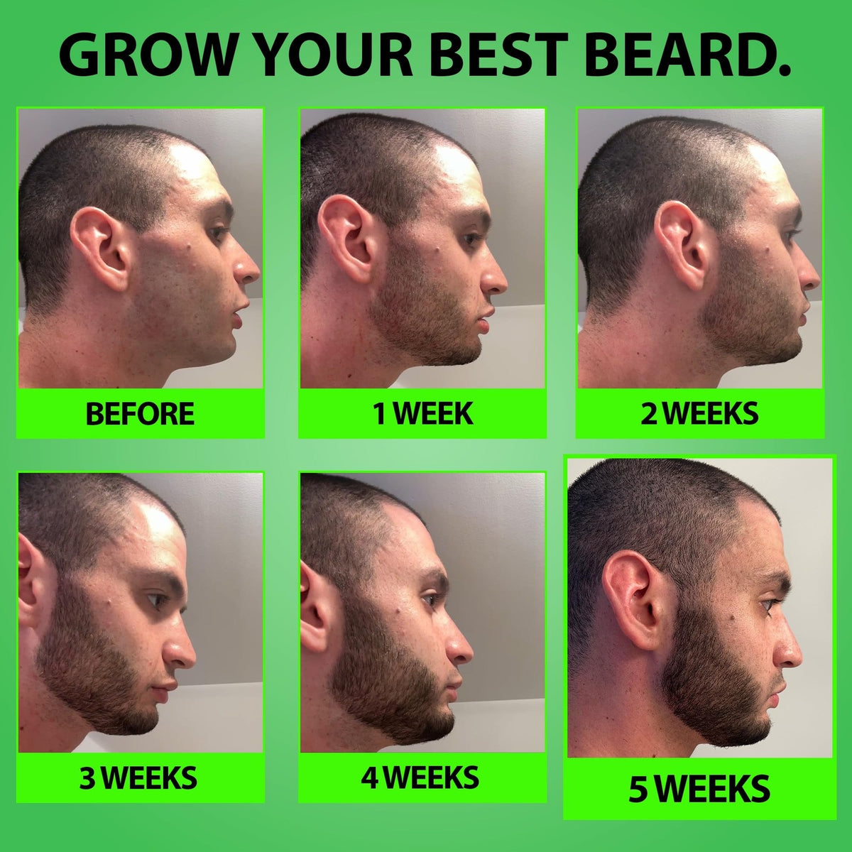 5% Minoxidil Beard Growth Serum - With Biotin & Rice Water