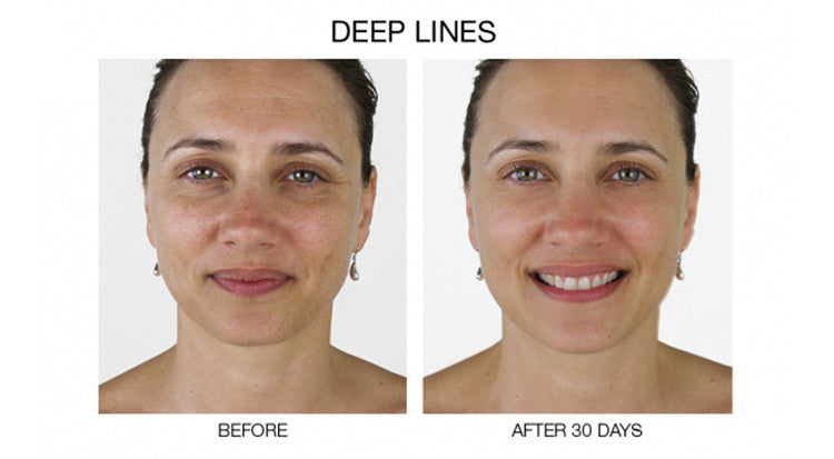 Anti-Aging Face Serum with Plant Stem Cells Hyaluronic Acid Matrixyl 3000