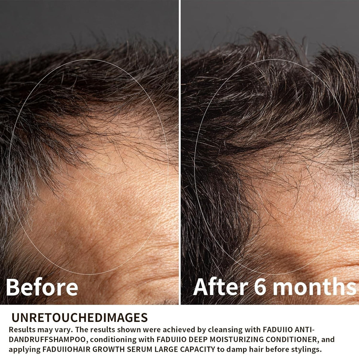 Hair Growth Serum with Biotin, Peptides & Caffeine - 2 oz
