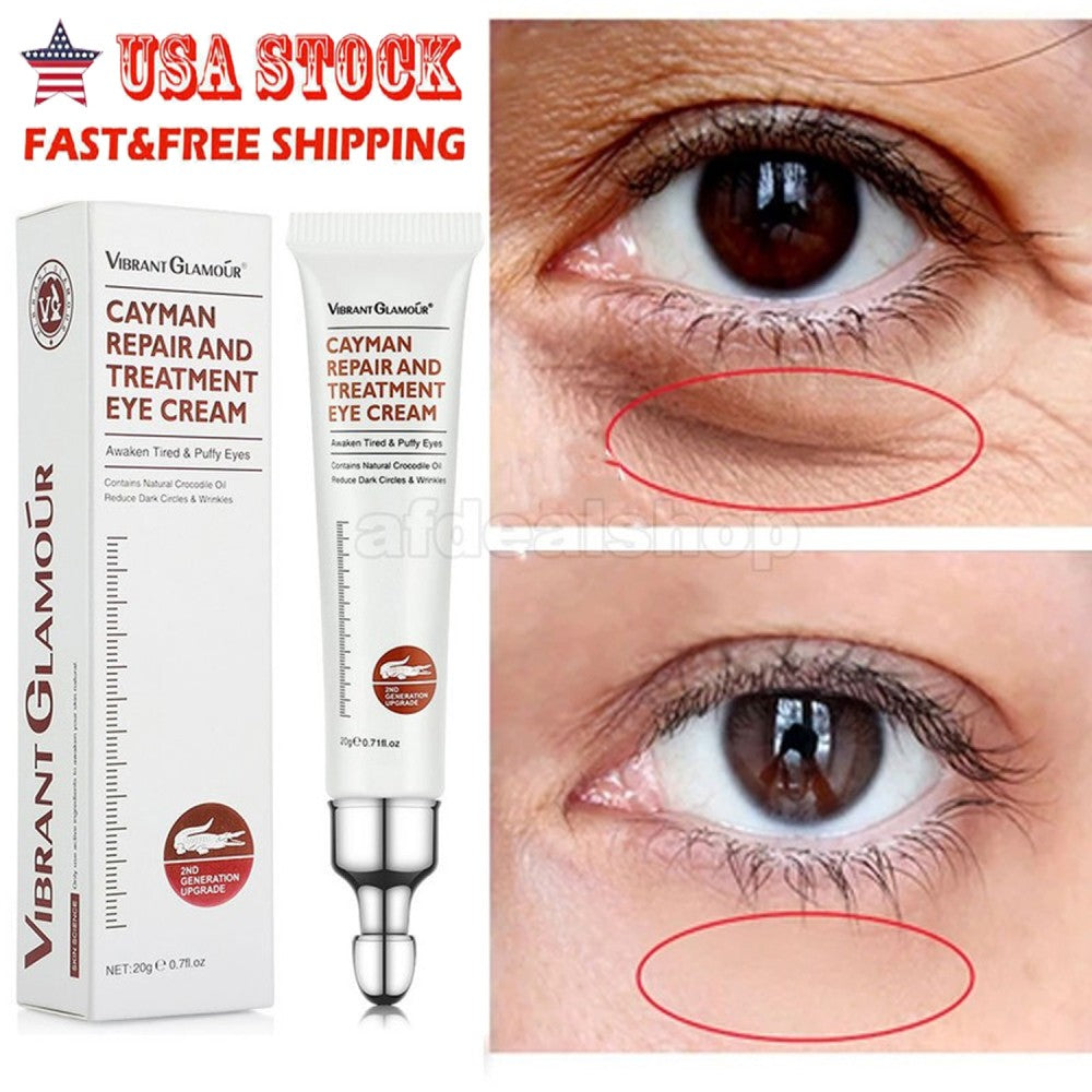 Instant Firming Eye Cream for Dark Circles & Wrinkles - 20g, 1-5 Pack