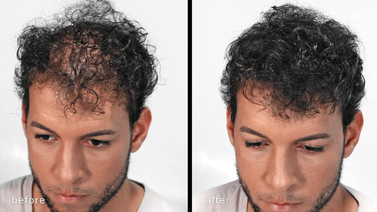 Hair Building Fibers, Volumizing Keratin Thinning Hair, Loss