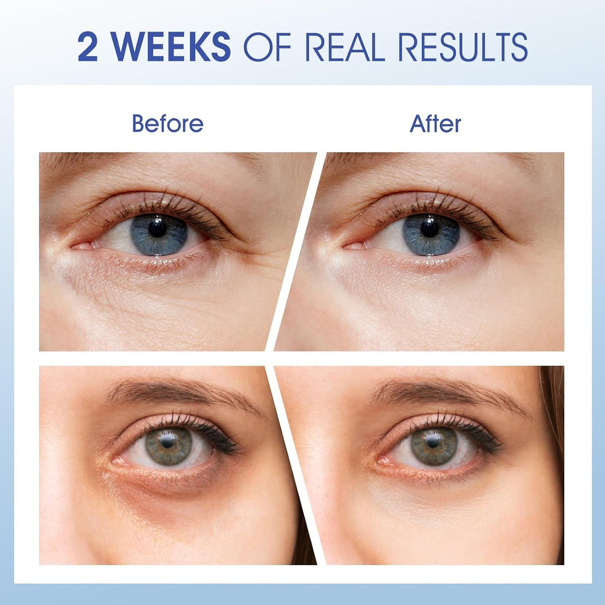 Luxury Under Eye Cream with Peptides and Caffeine - Rejuvenate Skin, 0.5 Oz