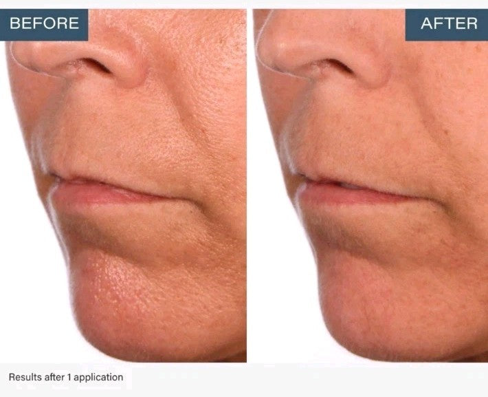 Skinn Non-Negotiables DERMAPPEAL Microdermabrasion 8 oz Refillable