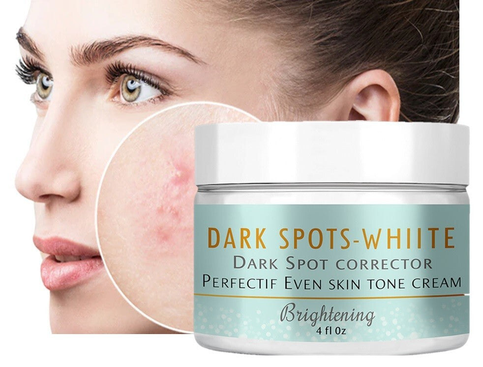 Dark Skin Tone Support Cream with Retinol - Even Skin Tone & Radiance, 4 oz