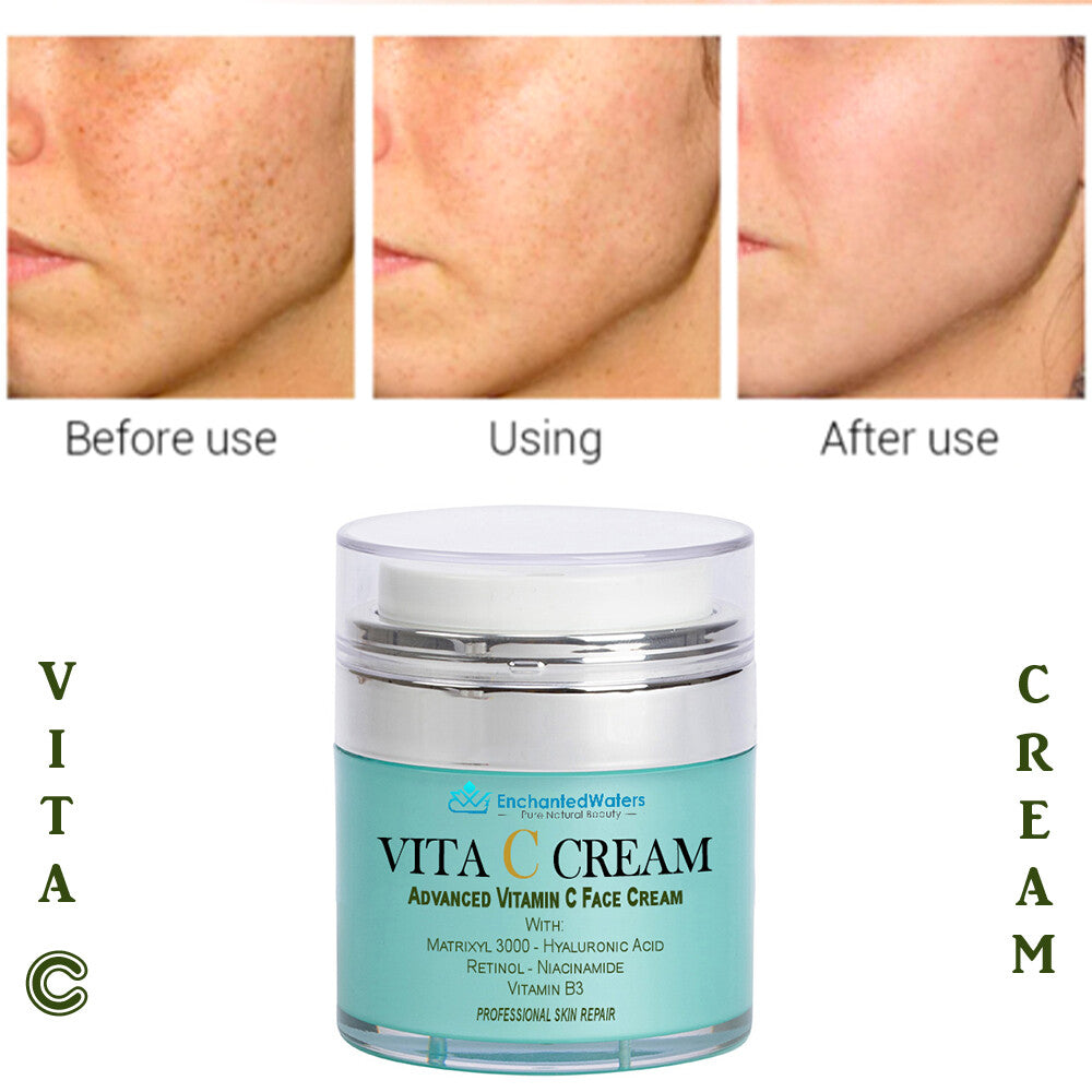 Advanced Vitamin C Anti-Aging Cream - Matrixyl 3000 & Hyaluronic Acid