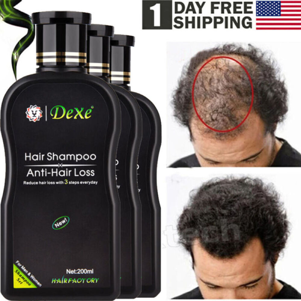 200ml Dexe Anti Hair Loss Shampoo Natural Herbal Growth Treatment