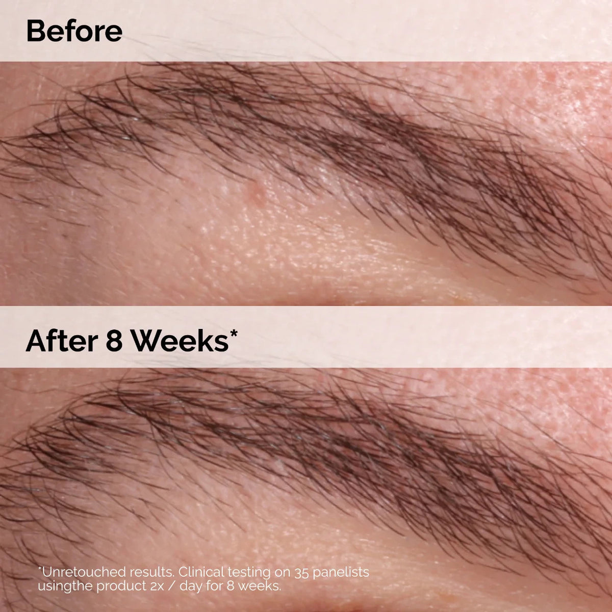 The Ordinary Multi-Peptide Lash and Brow Serum 2 Pack - Eyebrow & Eyelash Growth