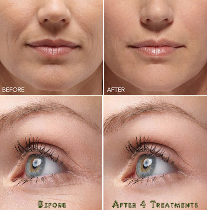 Hyaluronic Acid Gel Cream – Anti-Aging Face & Eye Moisturizer