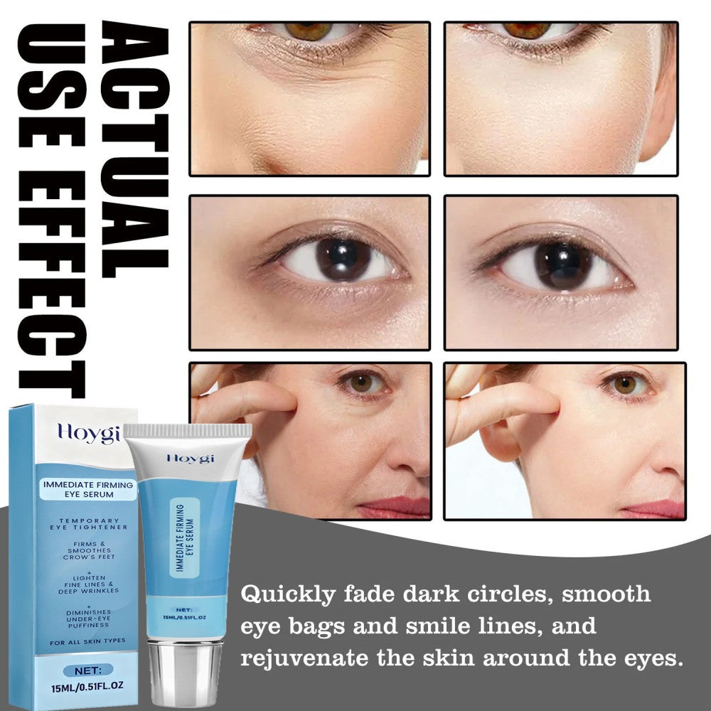 Firming Eye Serum for Dark Circles Wrinkles and Puffiness - 1-10X Quantity Options
