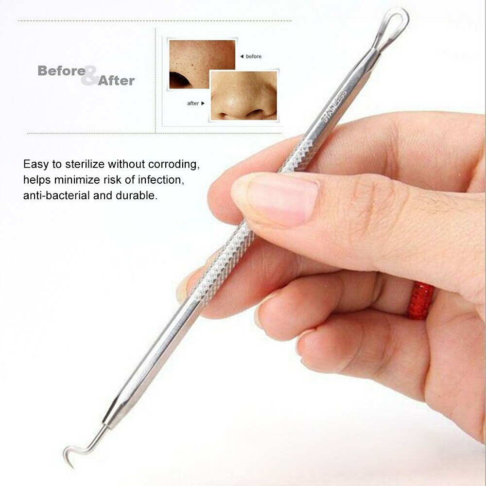 Blackhead and Acne Comedone Extractor Kit - Stainless Steel Pimple Remover with Tweezers & Case