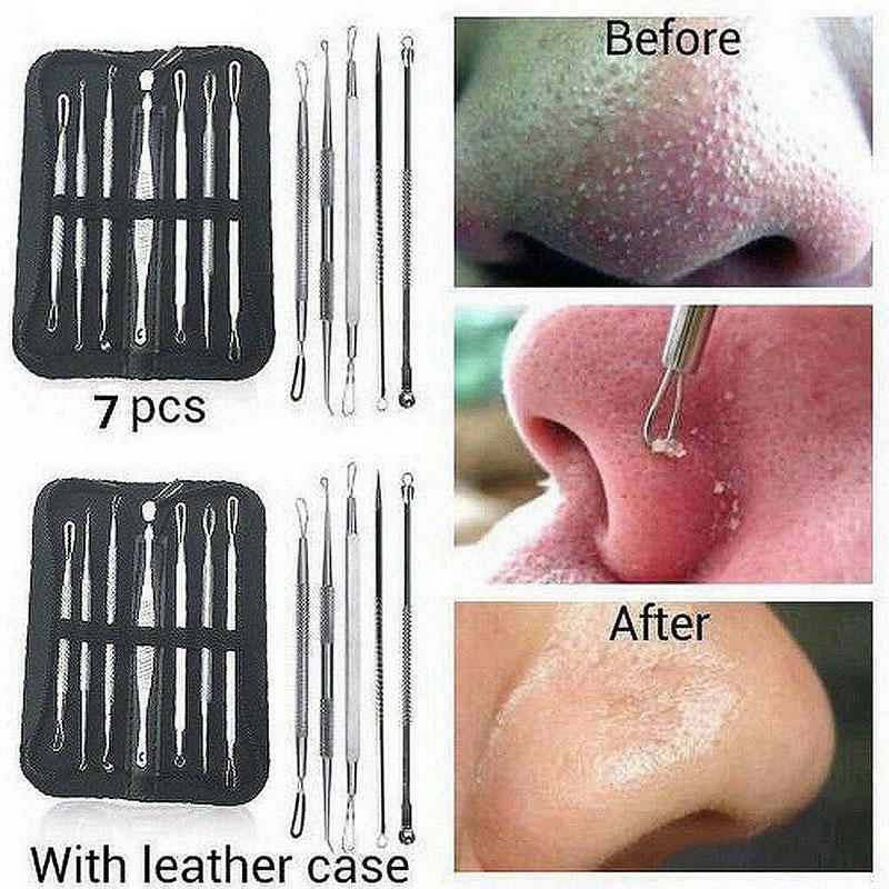 Blackhead Remover Kit - 9 PCS Comedone Extractor Pimple Popping Tools for Acne & Blemishes