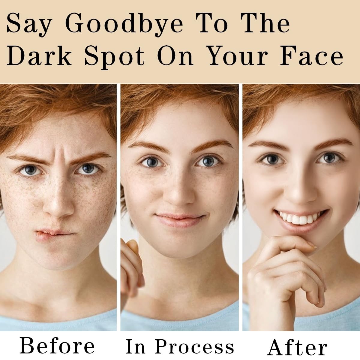Dark Spot Remover Cream for Face & Body - Brightening Hyperpigmentation Treatment