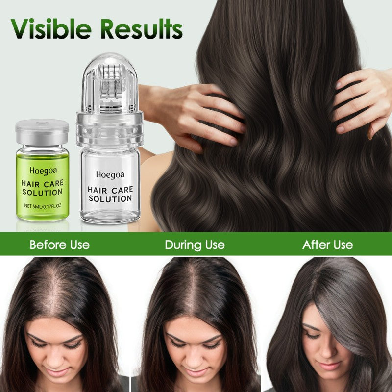 Hair Growth Serum with Microneedle Roller - Scalp Nourishing Treatment