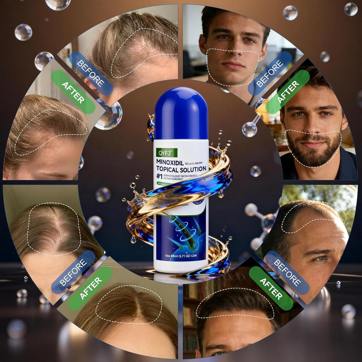5% Minoxidil Hair Growth Serum for Men & Women - 3 Pack