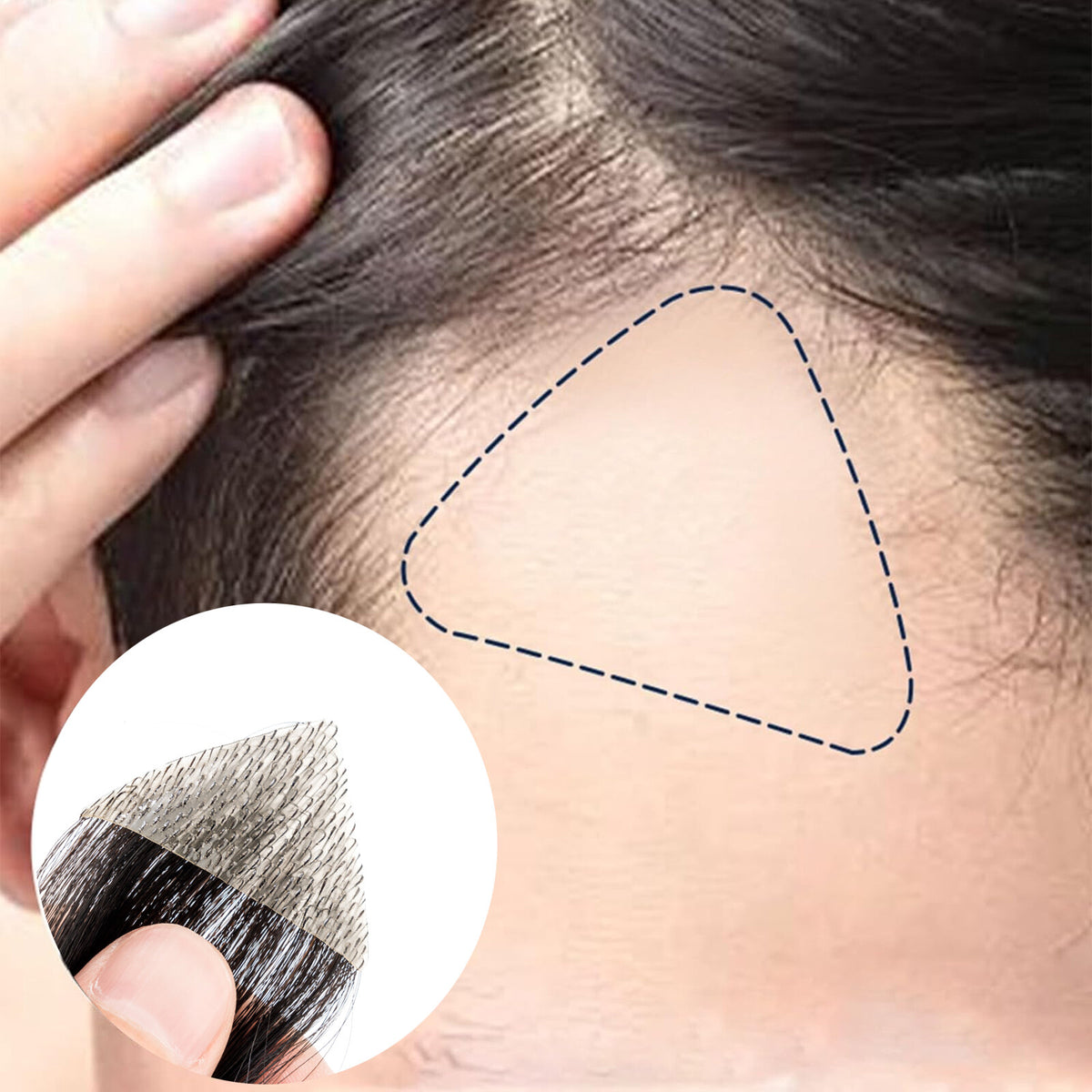 Men's Hair Loss Replacement Patch for Receding Hairline and Bald Spots
