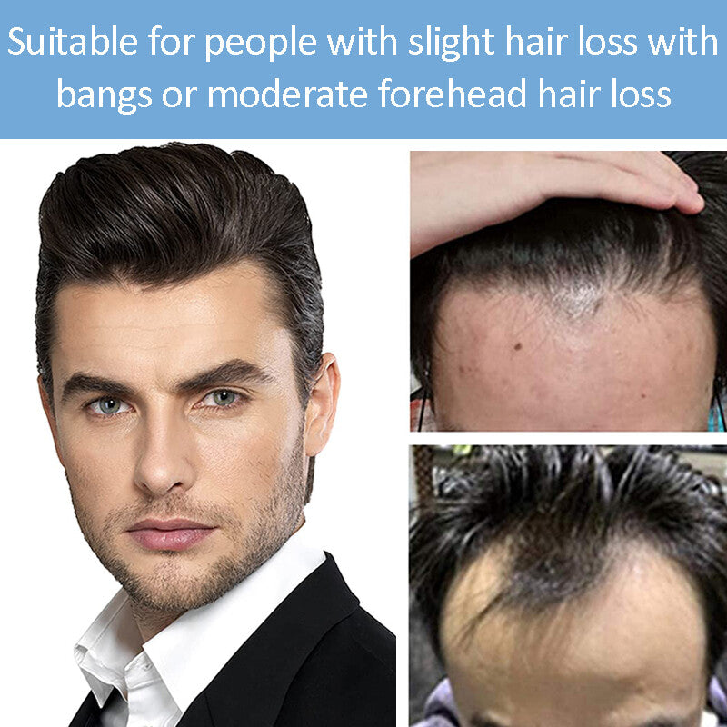 Men's Receding Hairline Toupee with Human Hair & Skin PU Base