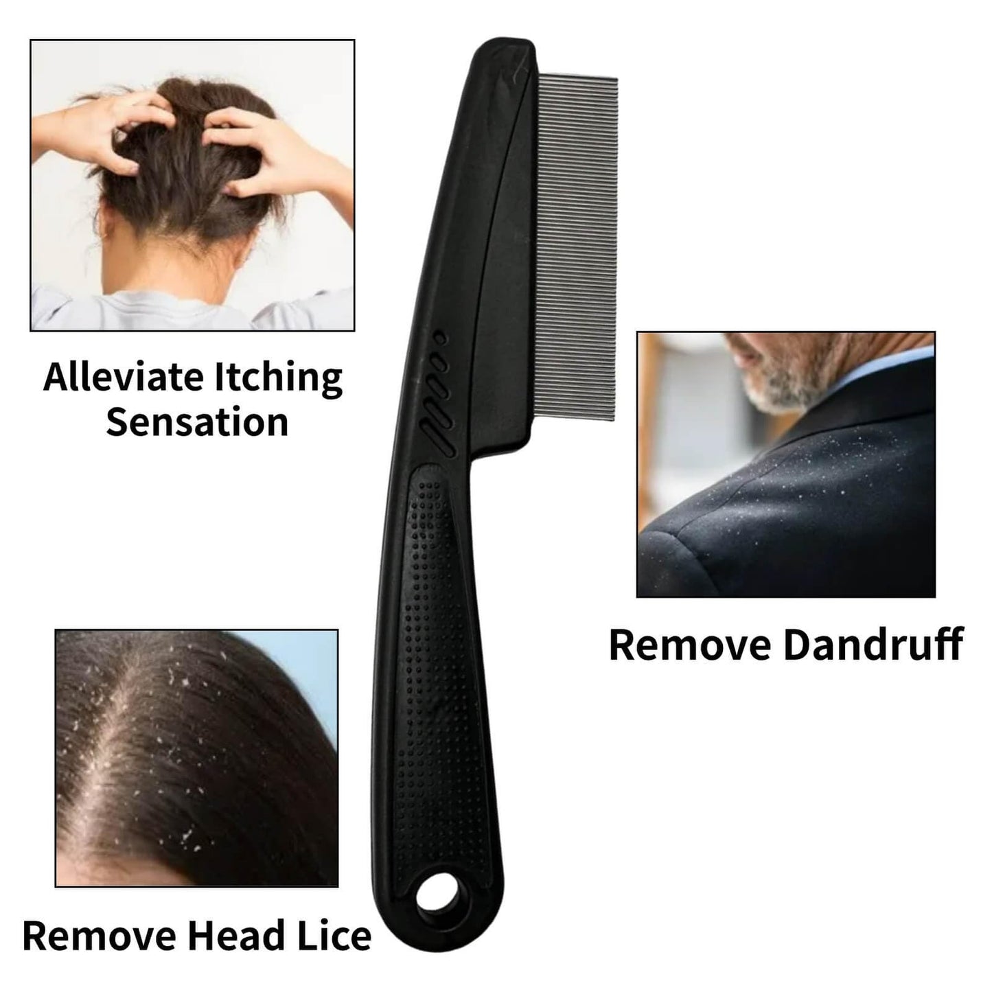 Stainless Steel Dandruff Comb for Scalp Hair Flake Removal - Fine Tooth, Portable, Anti-slip Grip