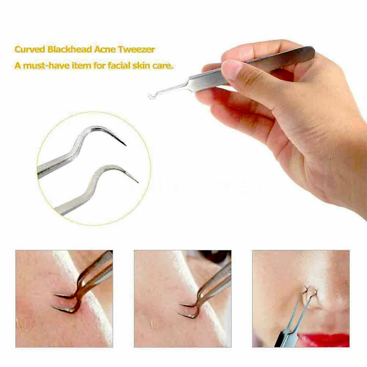 9Pcs Blackhead Acne Pimple Extractor Kit with Travel Case - Professional Skin Care Tools
