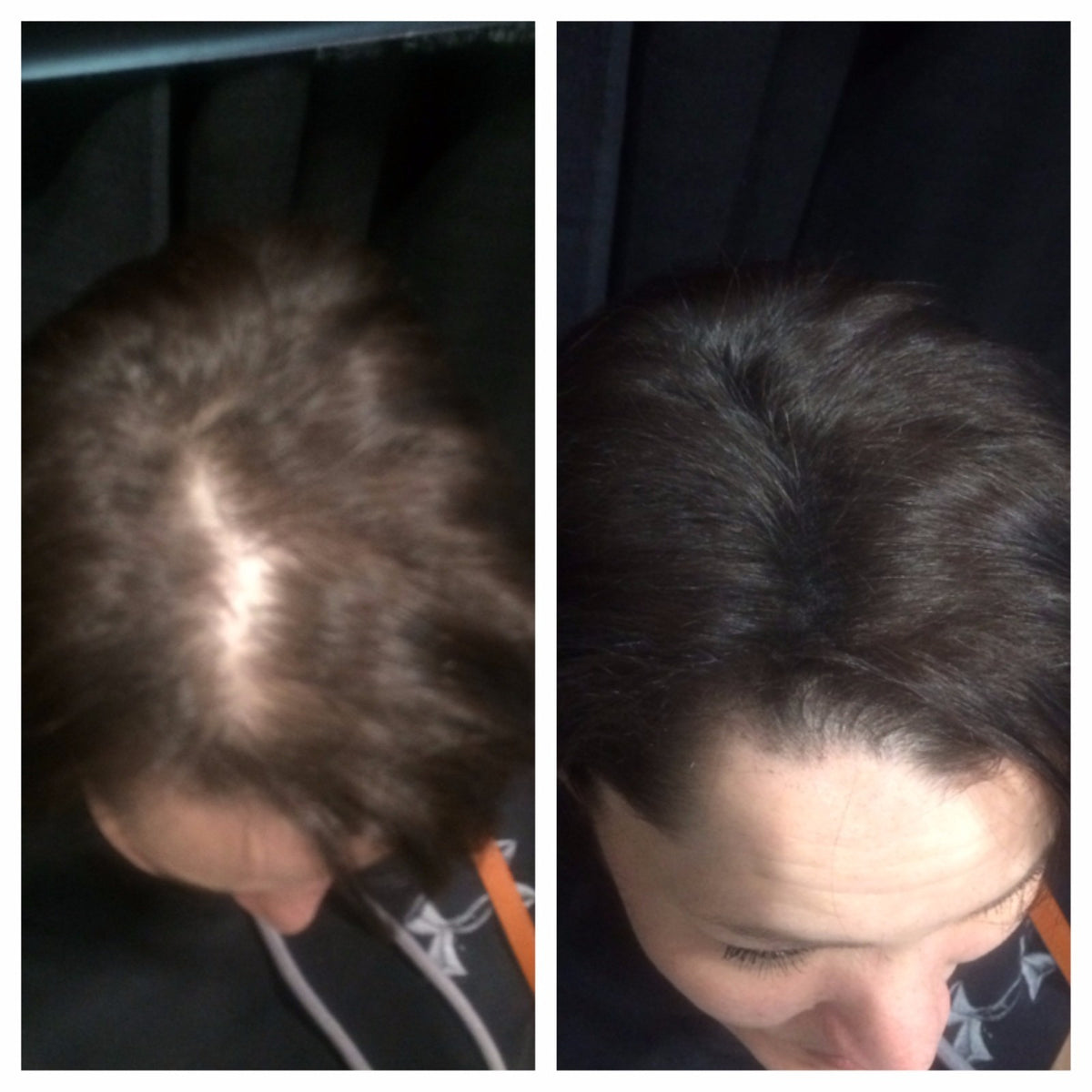 Hair Building Fibers - Real Hair Thickening Concealer (2x 38g)