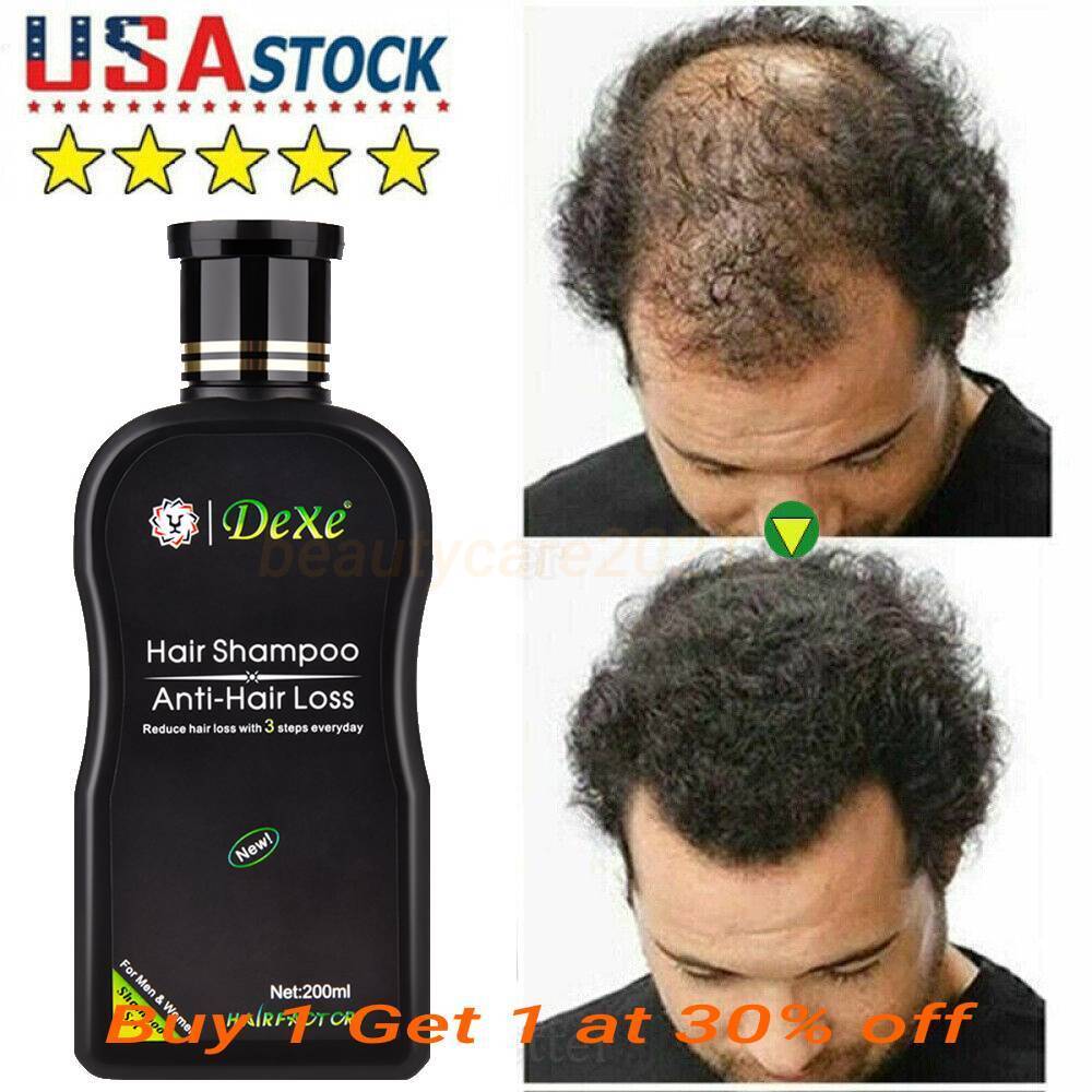 Anti Hair Loss Shampoo with Ginger - 200ml