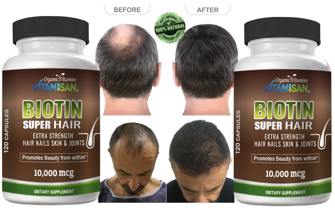 Biotin Hair Growth Vitamins - 120 Capsules