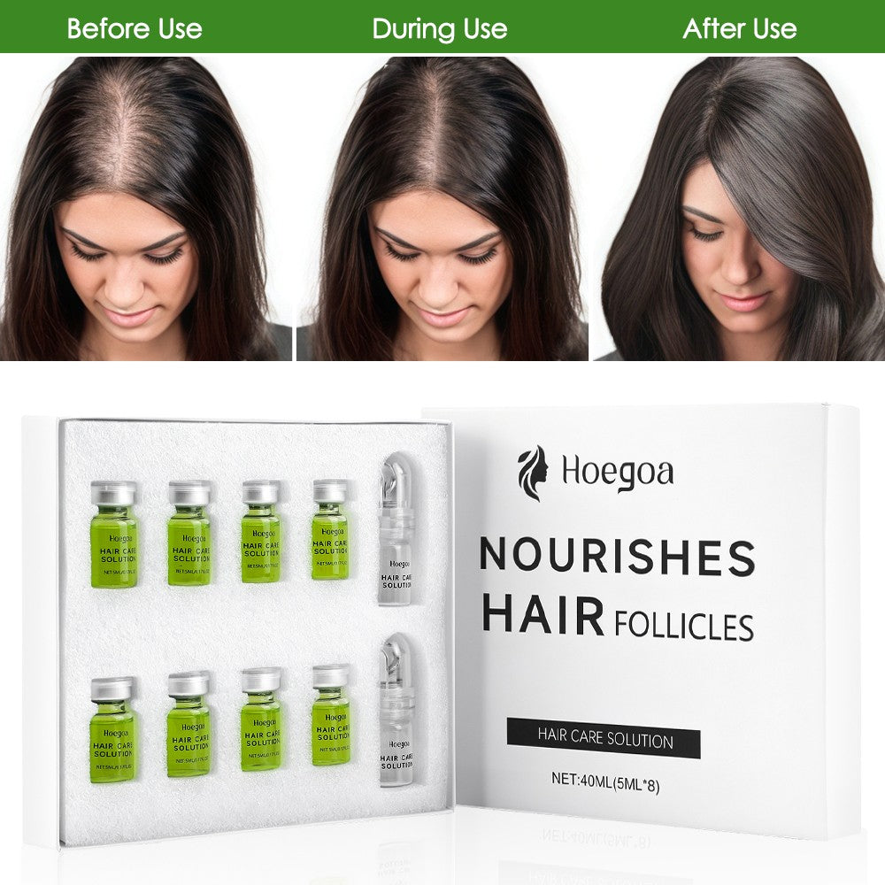 Hair Growth Serum Scalp Treatment Kit with Micro Needle Roller