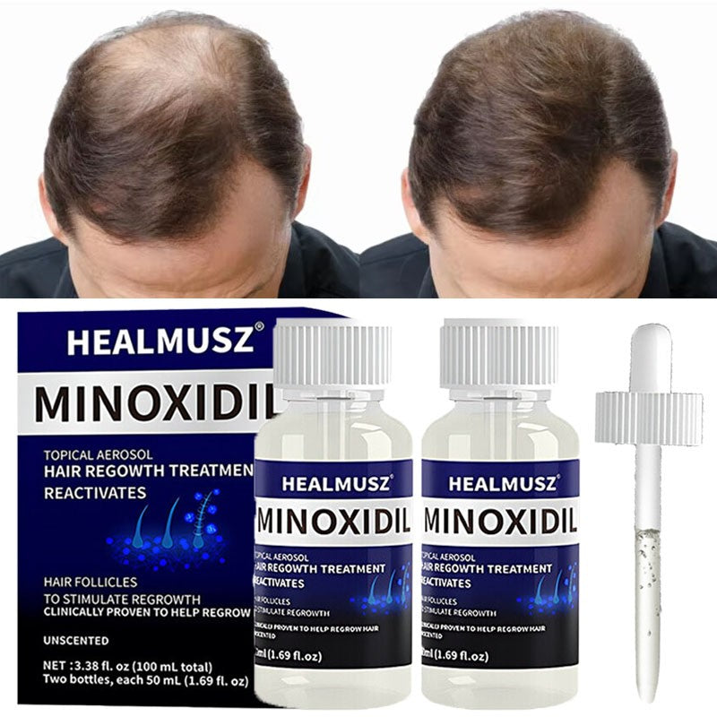 Minoxidil 5% Hair Regrowth Treatment for Men - 2 Pack