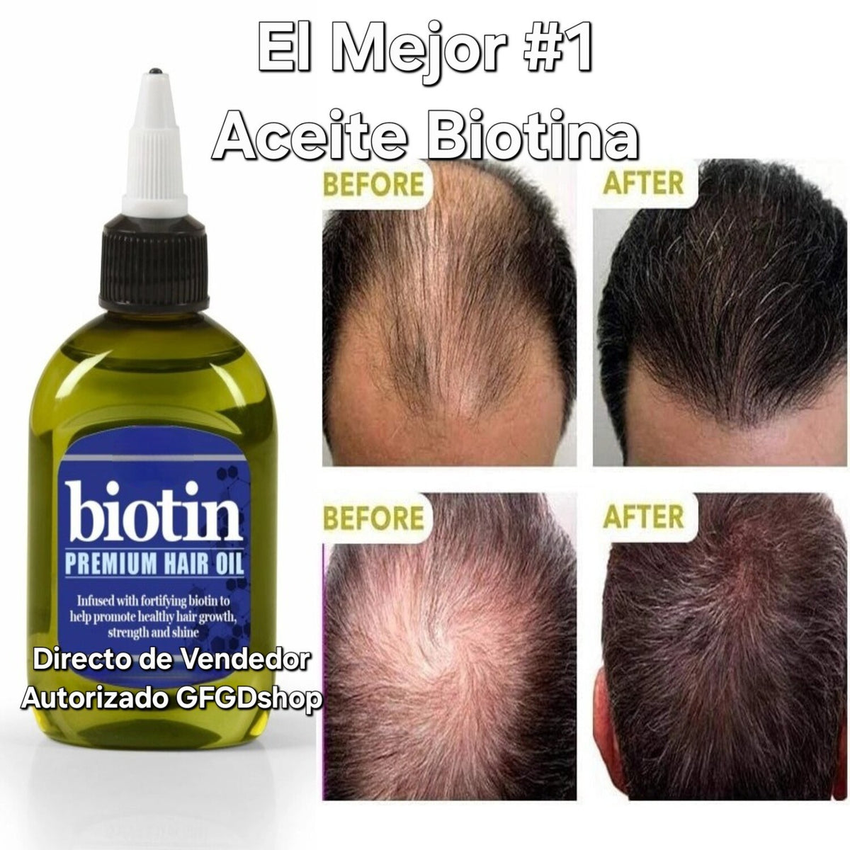 Biotin Hair Growth Oil - Natural Anti-Hair Loss Treatment