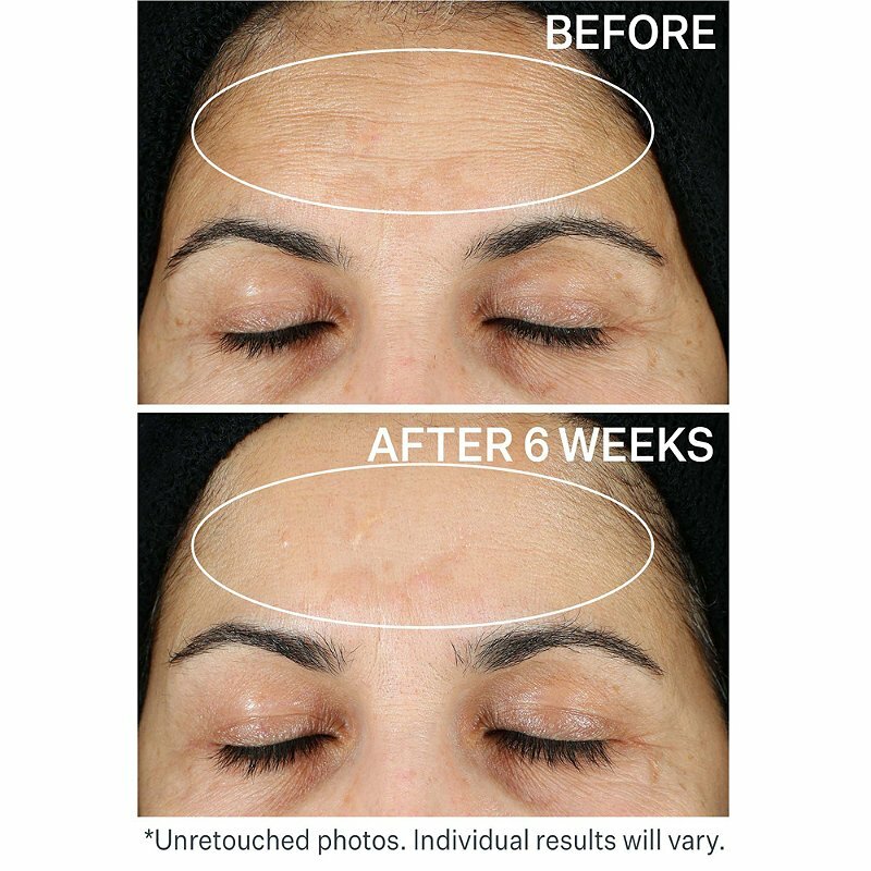 Retinol Moisturizer with Hyaluronic Acid - Anti-Aging Day & Night Cream 2.5%