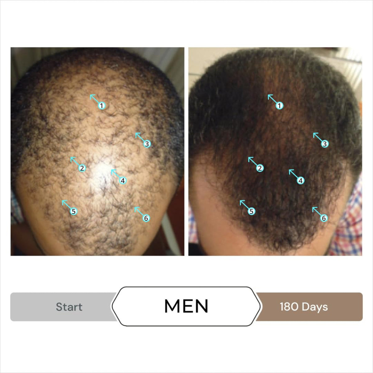 Men's Hair Density Serum Spectral Booster Leave-In Thickening