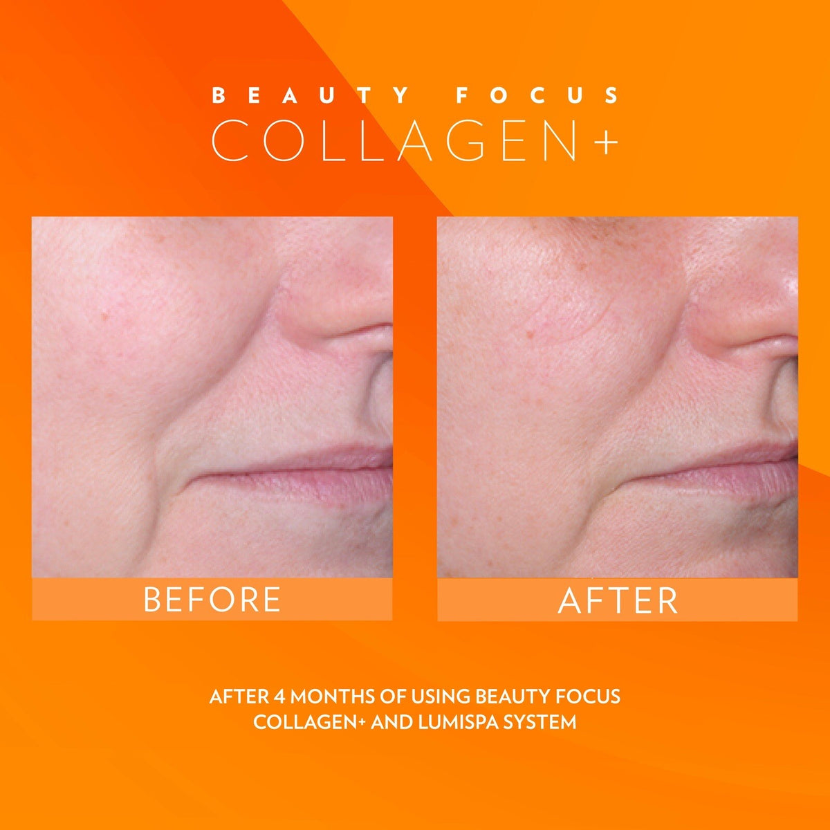 Liquid Collagen Drink for Skin Radiance and Anti-Aging - Peach Flavor, 30 Days Supply
