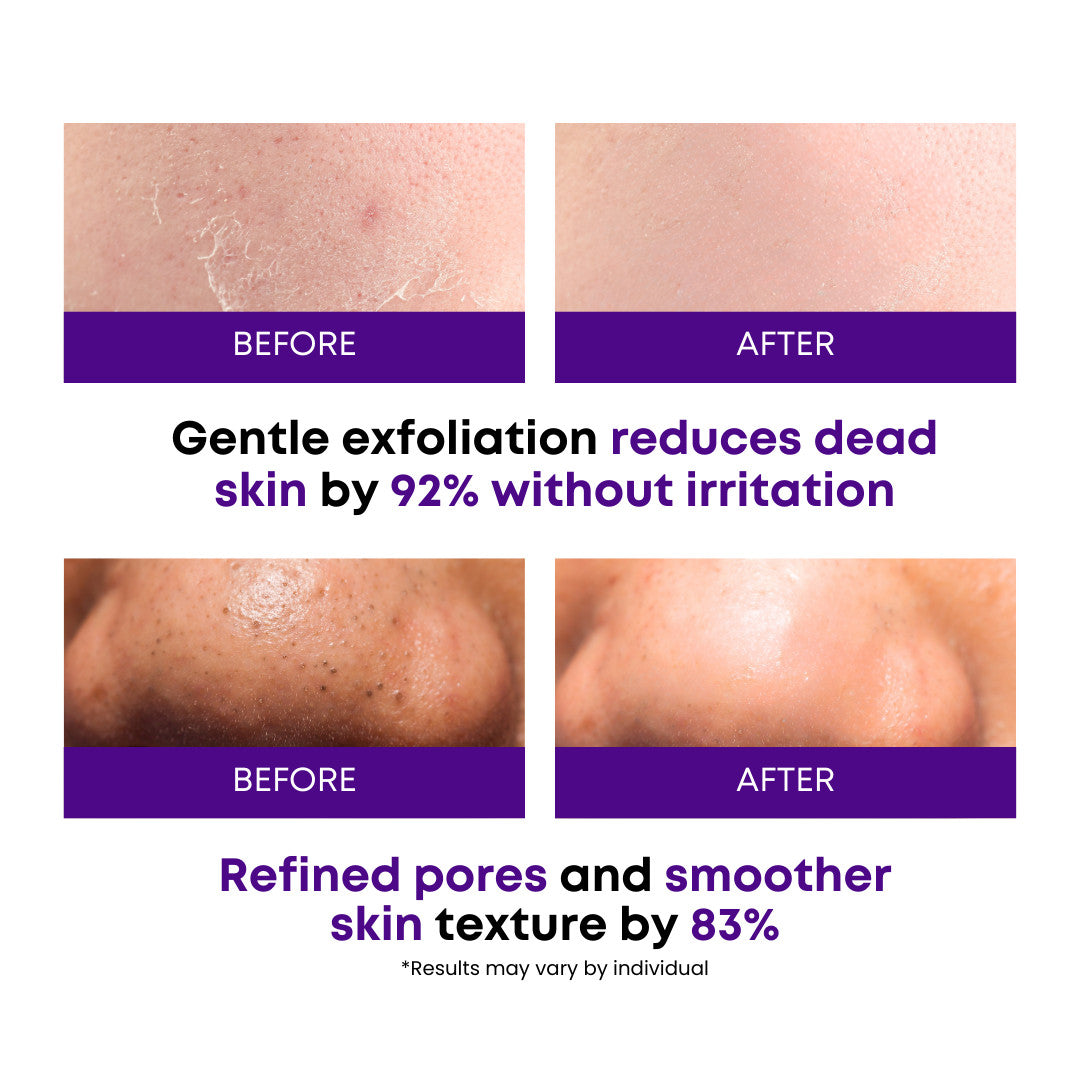 SOMISOME Peeling Toner Pads Zero Pore, Mediheal, Moisturizing Korean