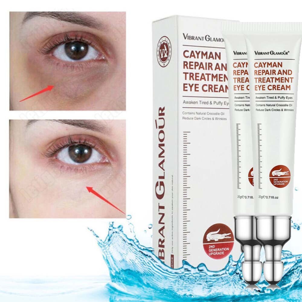 Collagen Eye Cream Anti-Aging Wrinkle & Dark Circle Treatment - Multiple Quantities