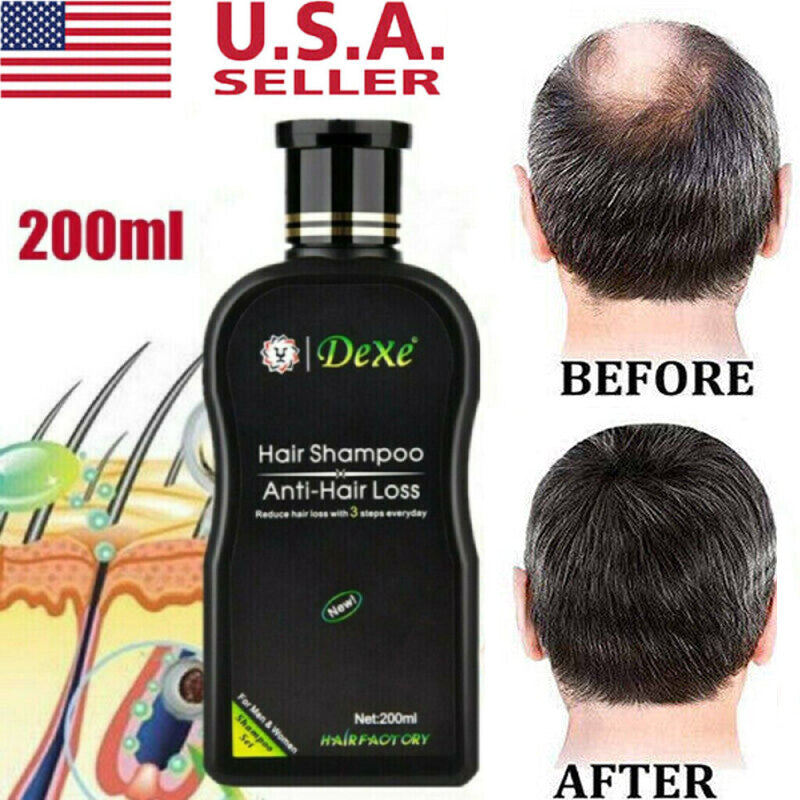 DEXE 200ml Anti-Hair Loss Shampoo Promote Hair Growth for Men & Women