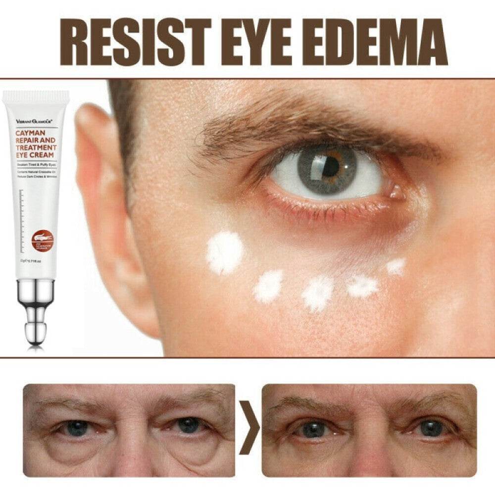 Anti-Aging Eye Cream Gel for Dark Circles & Bags - Brightening & Firming