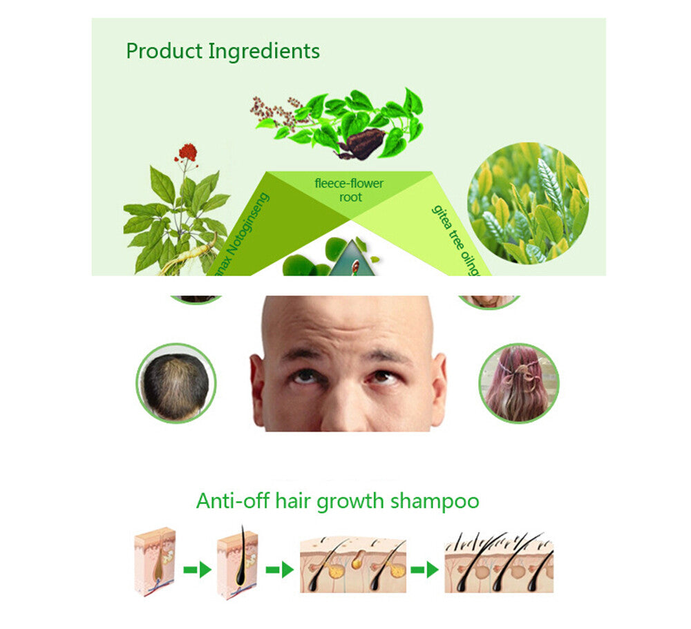Anti-Hair Loss Shampoo for Men & Women - 200ml