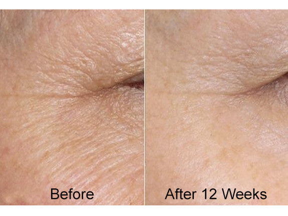 Hyaluronic Acid + Retinol Anti-Aging Serum 2-Pack