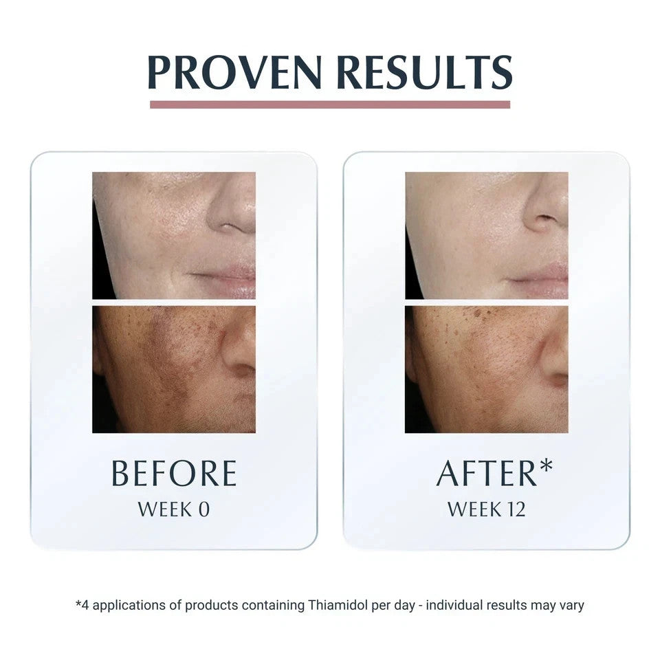 Eucerin Anti-Pigment Dark Spot Corrector - Targeted Hyperpigmentation Relief 5ml